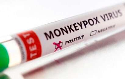 Estados Unidos aprobó un test para detectar la viruela del mono