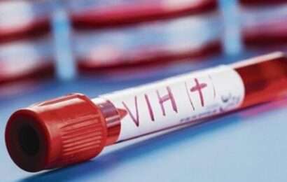 El 38% de los diagnósticos de VIH en jóvenes son tardíos
