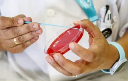 La sífilis acecha: en 2025 se notificaron 46.799 casos en el país 