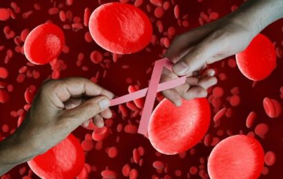 Cánceres de la sangre: hay 13.000 casos anuales en Argentina 